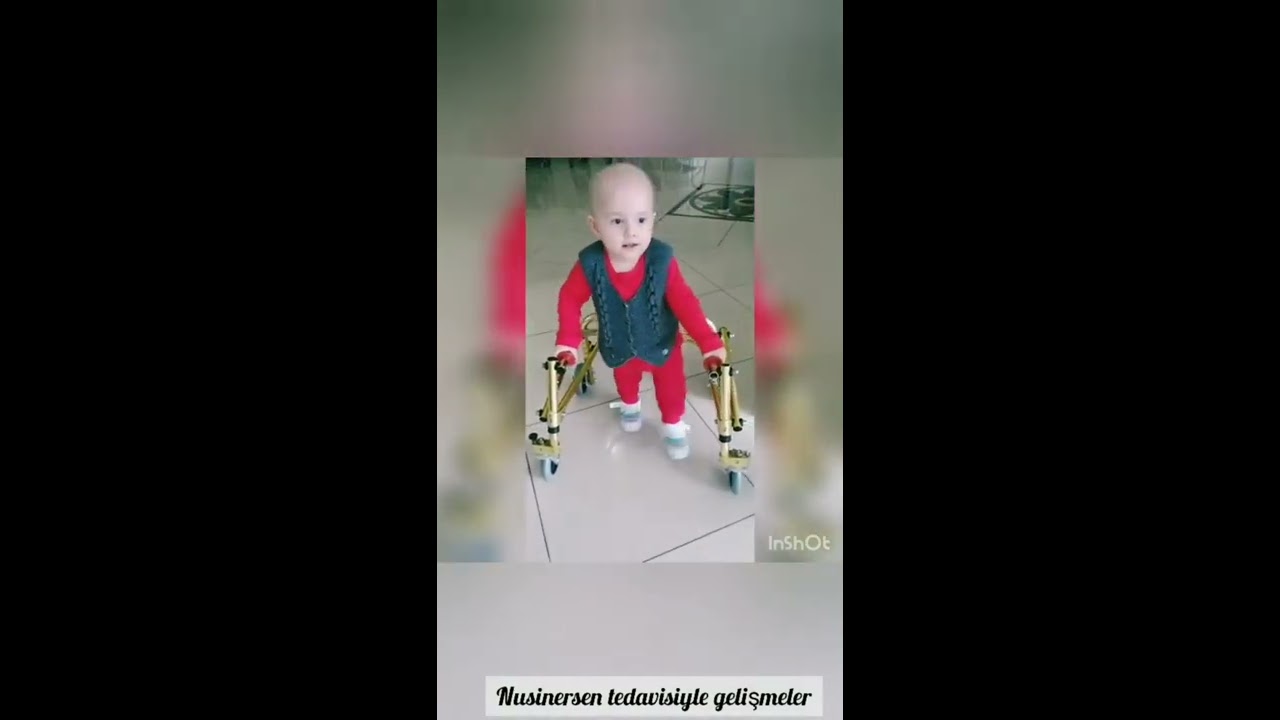 SMA Tip2 hastası Yağız'ın Nusinersen tedavisiyle gelişmeleri
