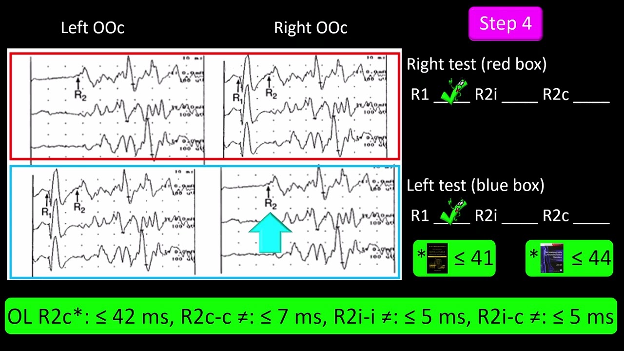 Blink Reflex Test. Practice 1