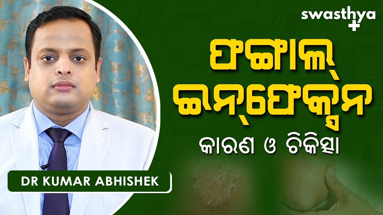 ଫଙ୍ଗାଲ୍ ଇନଫେକ୍ସନ - କେମିତି କରିବେ ଚିକିତ୍ସା? | Dr Kumar Abhishek on Fungal Infection Treatment in Odia