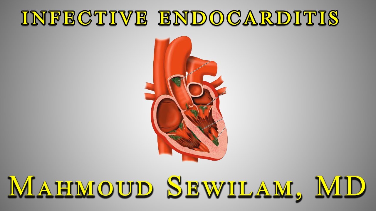 شرح ال Infective Endocarditis دكتور سويلم