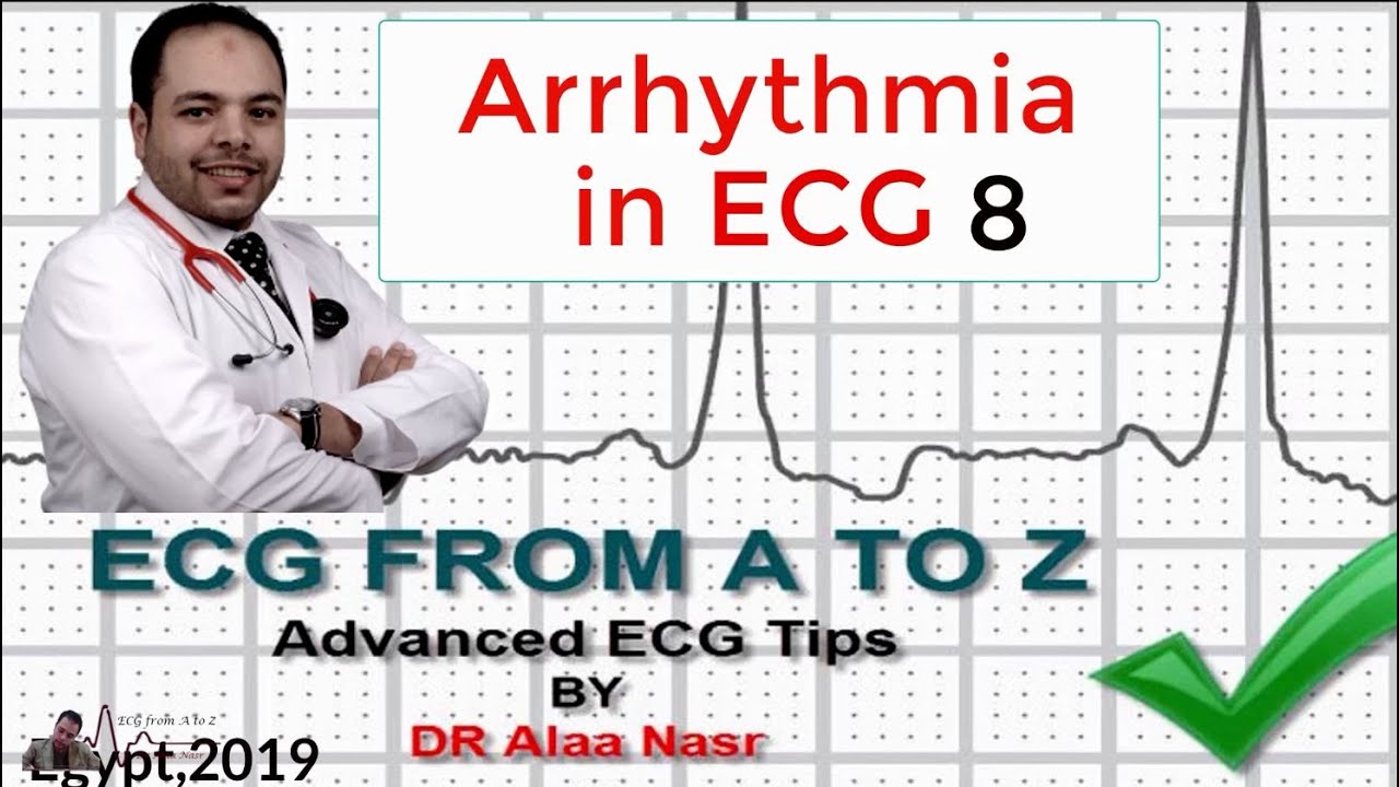 ECG from A to Z, intermediate level, Arrhythmia 8, Dr Alaa Nasr, 2019