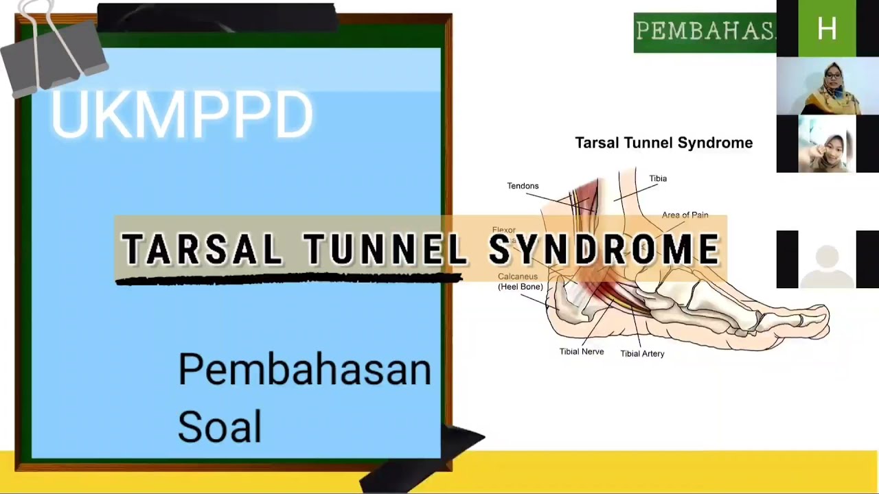 Tarsal Tunnel Syndrome Soal UKMPPD -  Mediglo Kelas ukmppd saraf pt 12