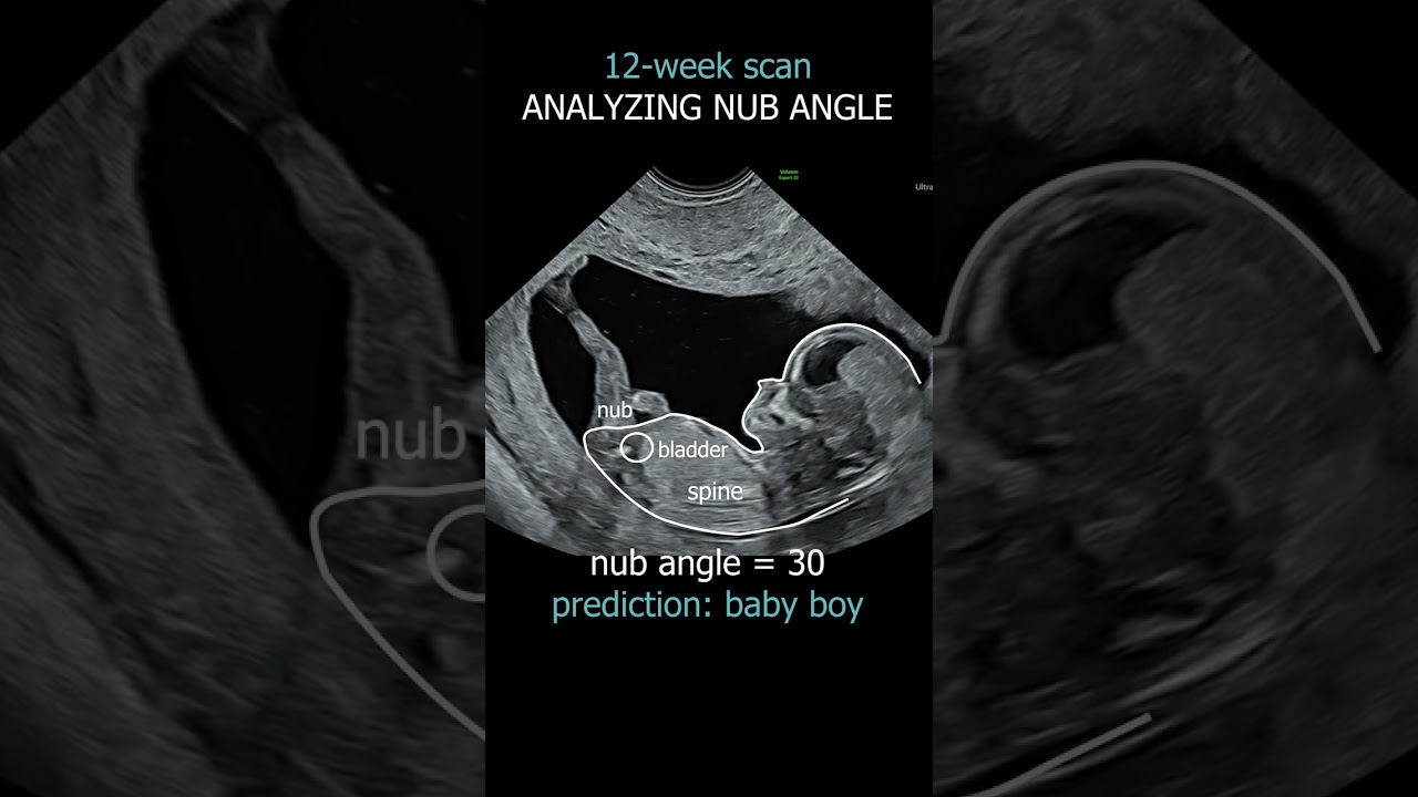 Gender reveal with NubX!