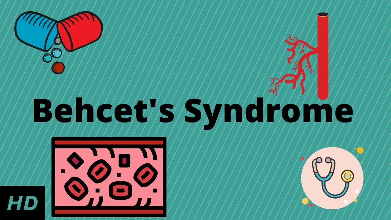 Behcet's Syndrome, Causes, Signs and Symptoms, Diagnosis and Treatment.