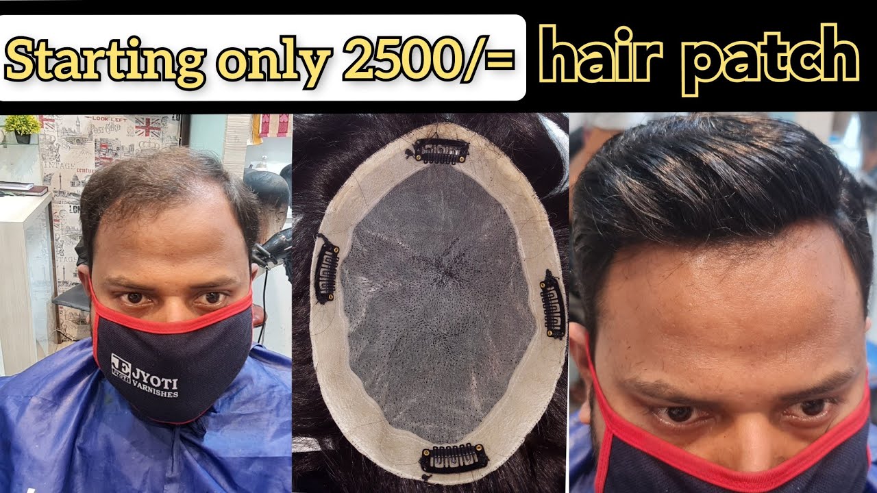 clipping system hair patch - hair replacement kolkata - glue system hair patch - hair wig in kolkata