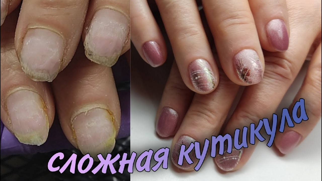 🙄СЛОЖНАЯ стелющаяся ПРИЛИПШАЯ кутикула