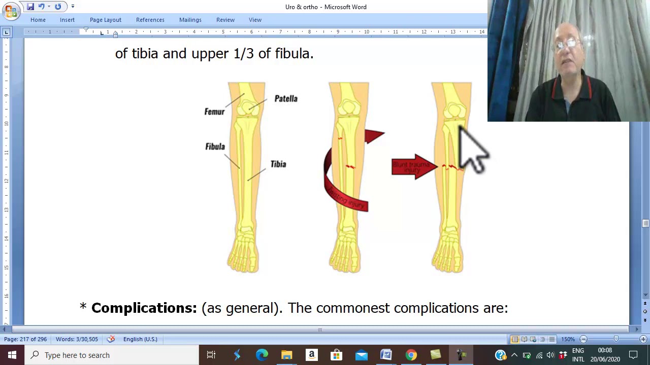 Orthopedic in Arabic 41  ( Fracture bones of leg ) , by Dr.Wahdan