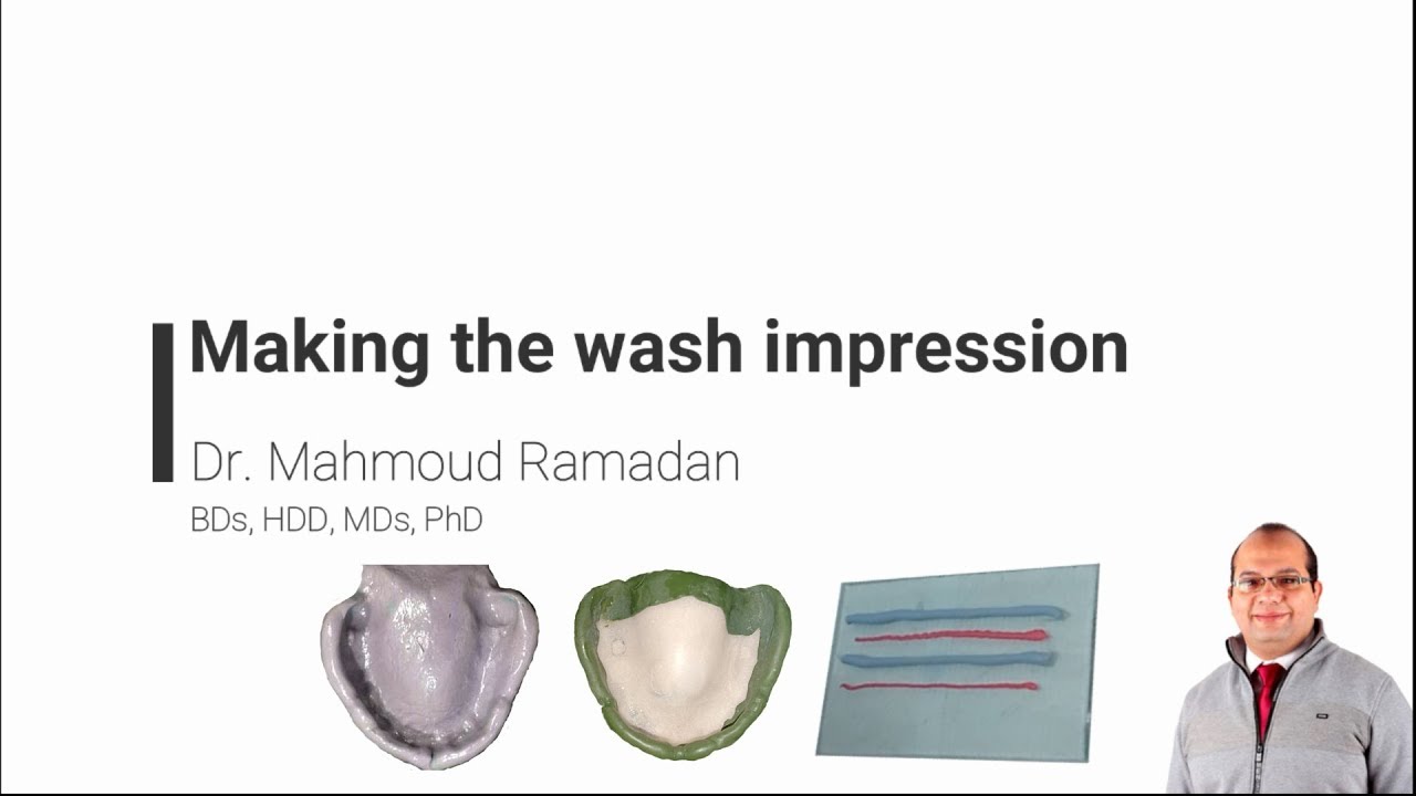17- Final impression of upper arch.  Part 3: Making the wash impression