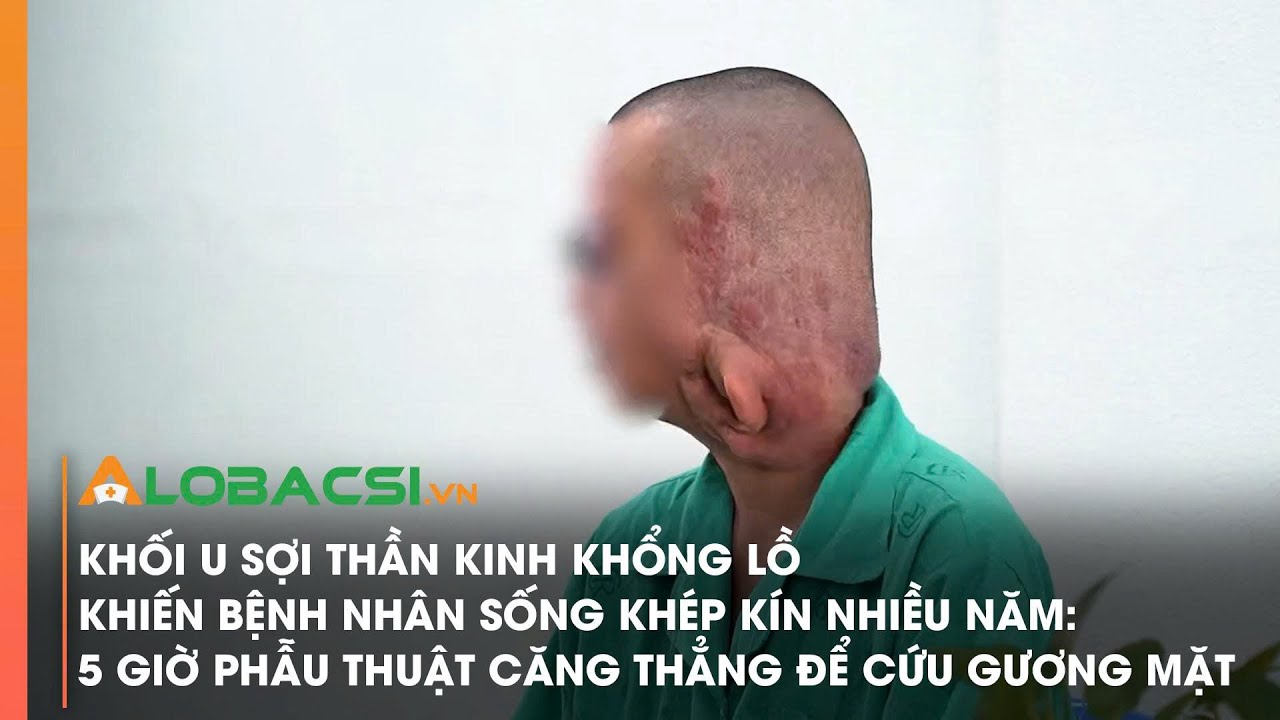 Khối u sợi thần kinh khổng lồ khiến bệnh nh&acirc;n sống kh&eacute;p k&iacute;n nhiều năm