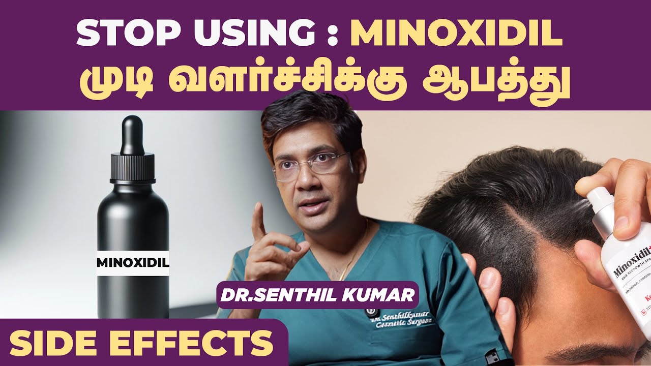 STOP🔴Dont use Minoxidil : மினாக்ஸிடில் உண்மை முகம் | Creas Cosmetic Center | Coimbatore