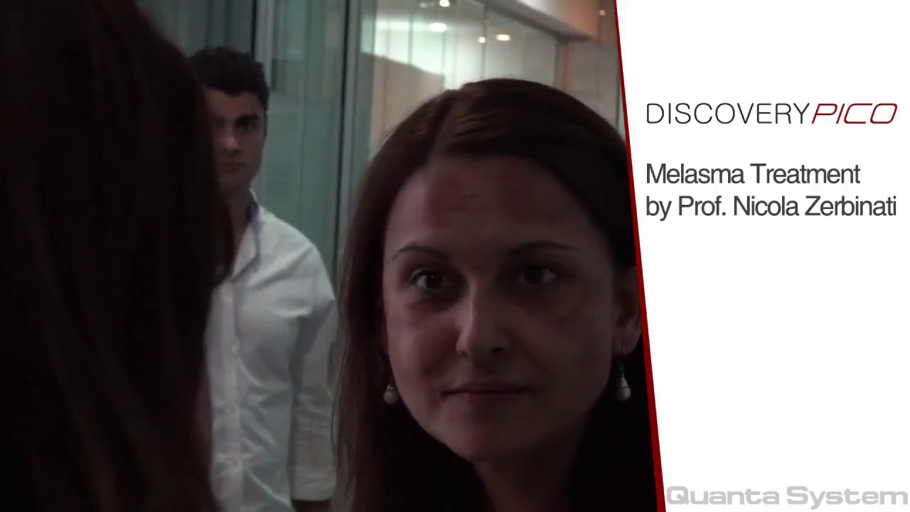 Quanta Discovery Pico Laser, Melasma Treatment