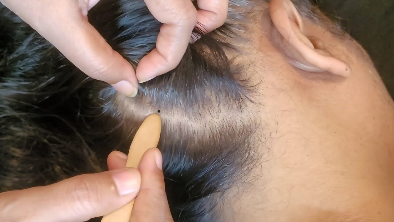 Scalp Check ASMR - Tingles for Hair Growth
