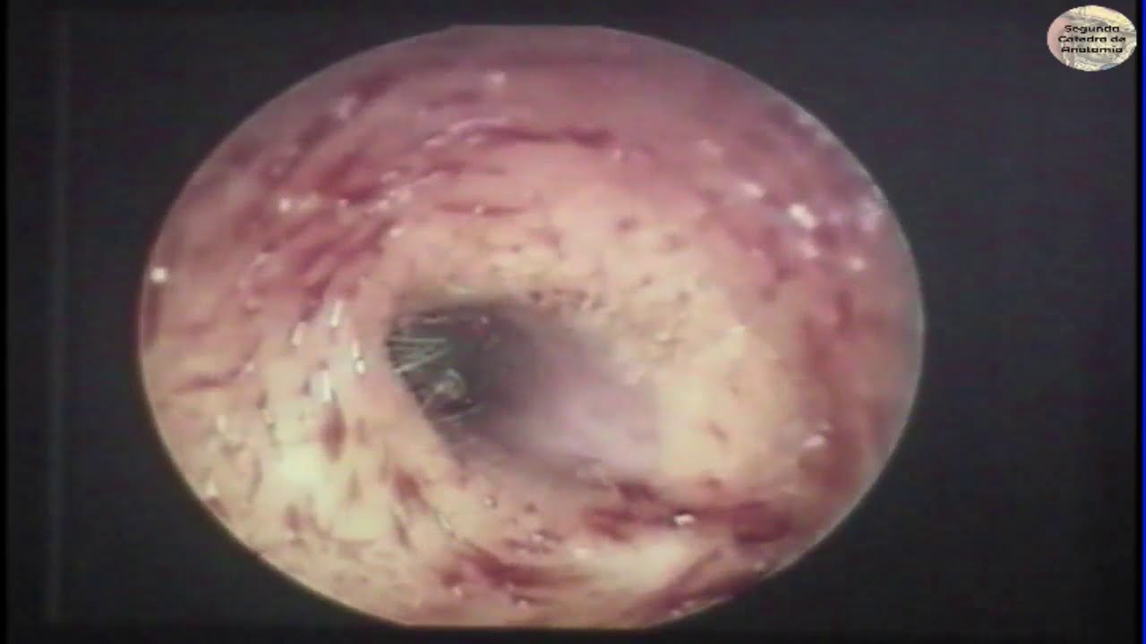N8 | Oído | Anatomía 2 | FMed UBA