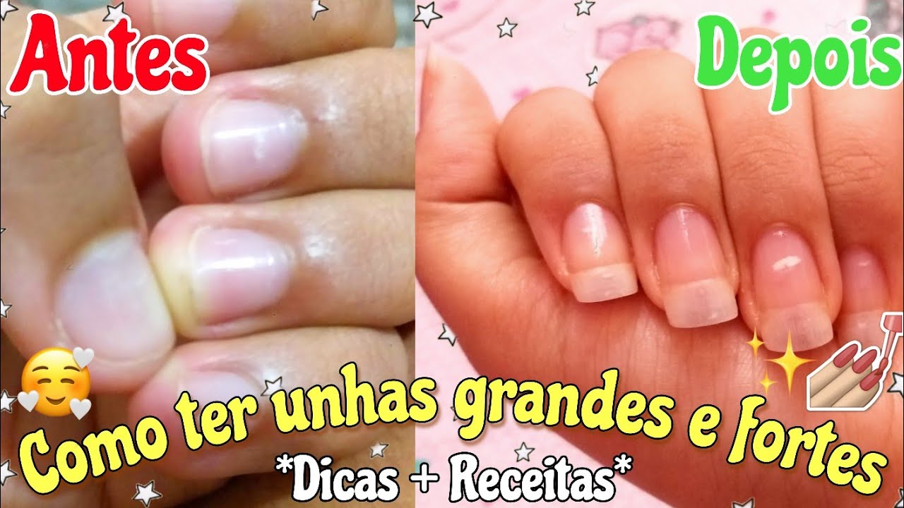 COMO TER UNHAS GRANDES E FORTES EM 3 DIAS 💅😱 Dicas + Receitinhas caseiras | Alana e Aline