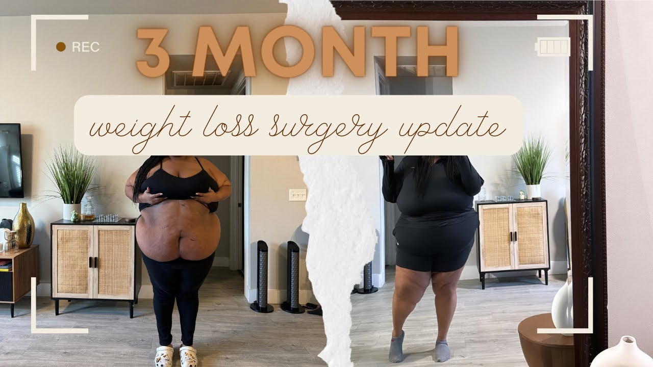 3 Month Weight Loss Surgery Update: Non Scale Victories, Loose Skin & Hair Loss