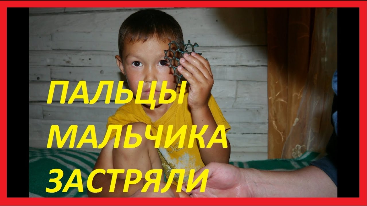 Работа-СПАСАТЕЛЬ. Деблокирование. Рука застряла в детской горке.