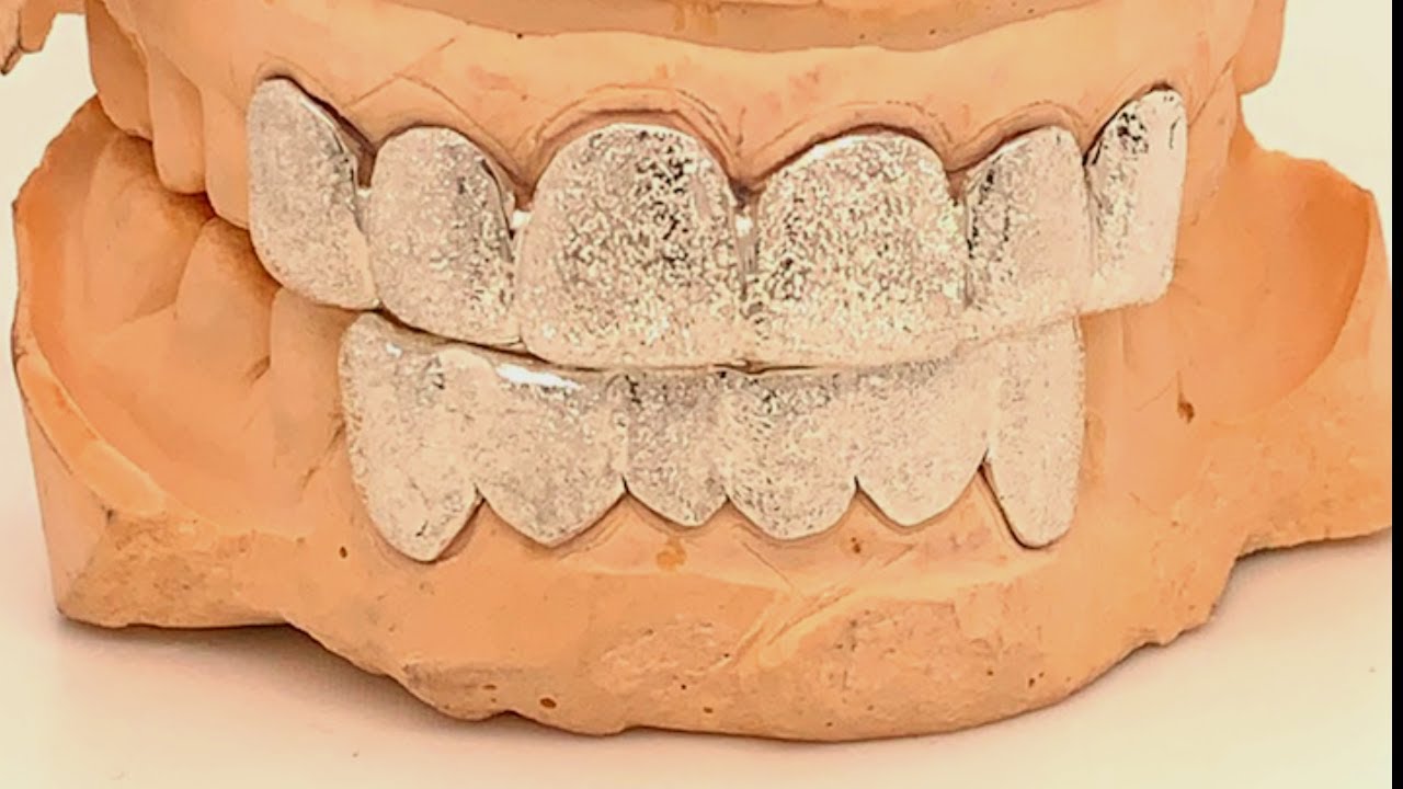 Diamond Dust Grillz Set by Seattle Gold Grills via Fred The Jeweler