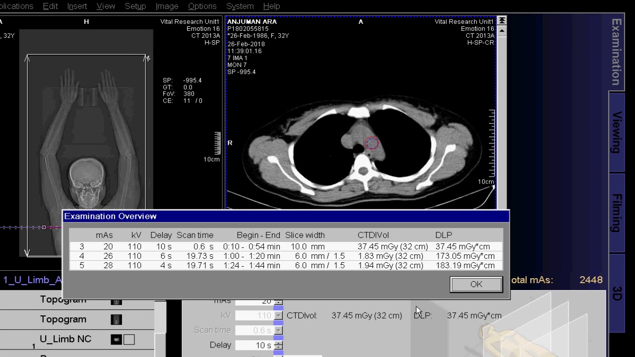CT Scan Of Upper Limb Angio
