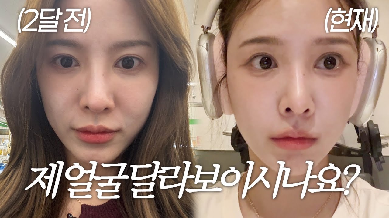 (SUB) Vlog | 얼굴이 달라진 이유 | 쥬베룩 볼륨 후기 | 콜라겐주사👼🏻 | 쇼핑 하울🛍️ | 미드 보며 영어공부 하는 법 | 시티브리즈 모델👗| 테라스에서 가을 만끽🍁
