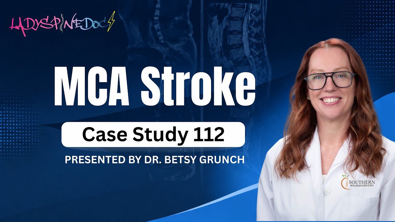 Case study 112 - MCA Stroke diagnosis and treatment EXPLAINED by Dr. Grunch, neurosurgeon