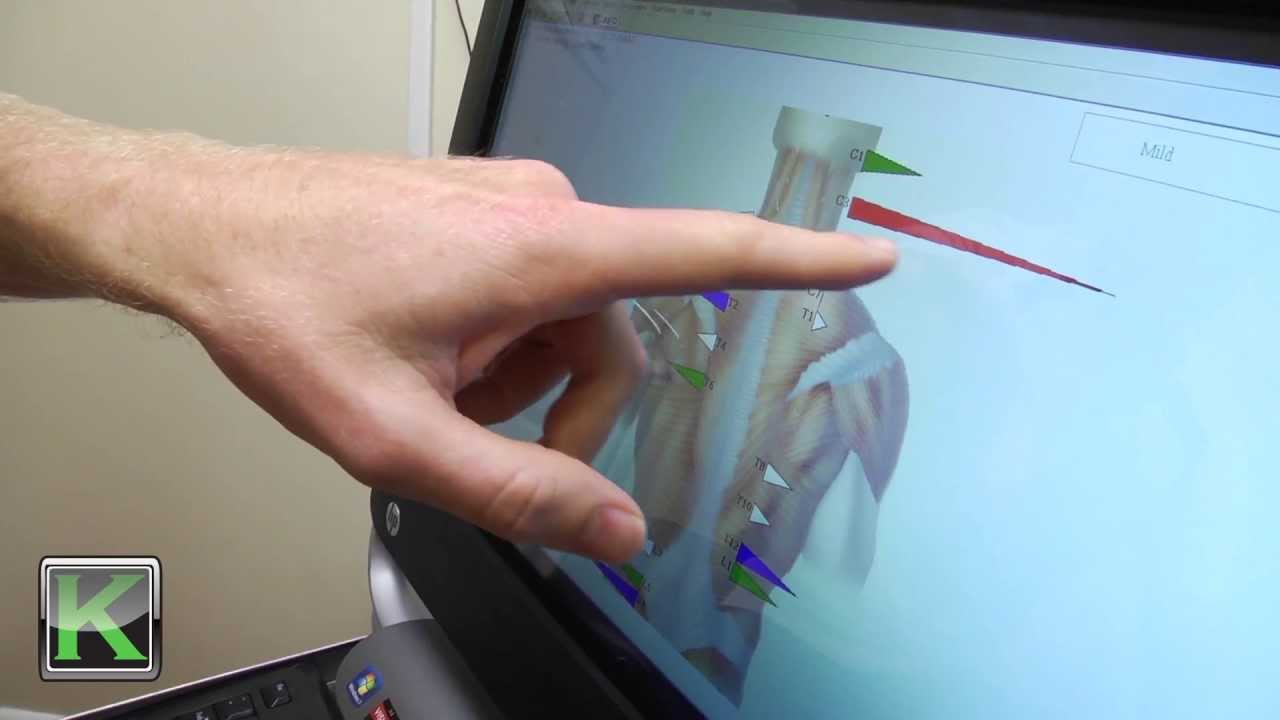 Digital Chiropractic - Static EMG
