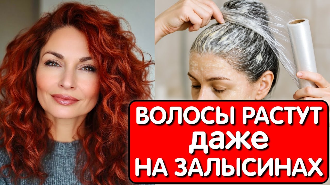 Эта МАСКА СПАСЛА ОТ ВЫПАДЕНИЯ ВОЛОС ! Нанесла это средство и мои ВОЛОСЫ РАСТУТ как сумасшедшие