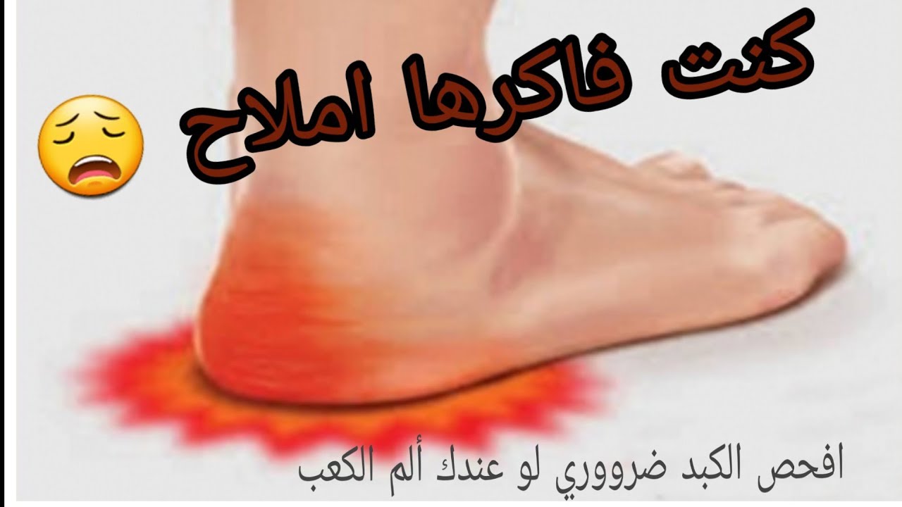 علاج الم كعب القدم بدون ادويه| زيت الحنظل