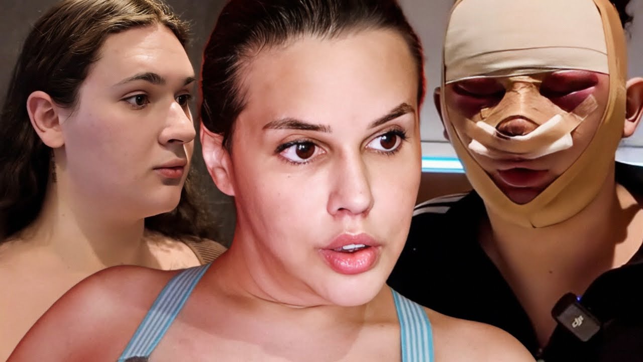 MULHER TRANS faz FEMINIZAÇÃO FACIAL na COREIA DO SUL e RESULTADO SURPREENDE 😮