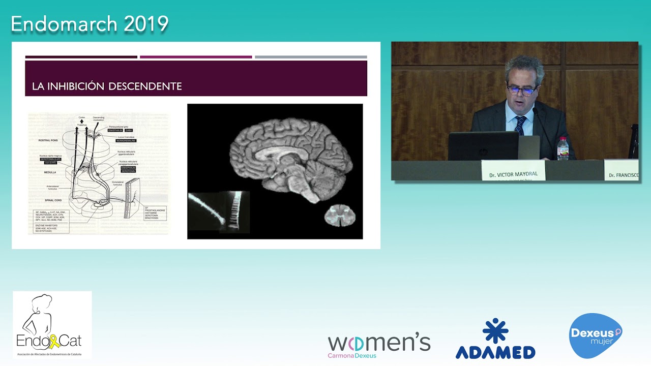 Dr. Victor Mayoral: El dolor crónico en la endometriosis.