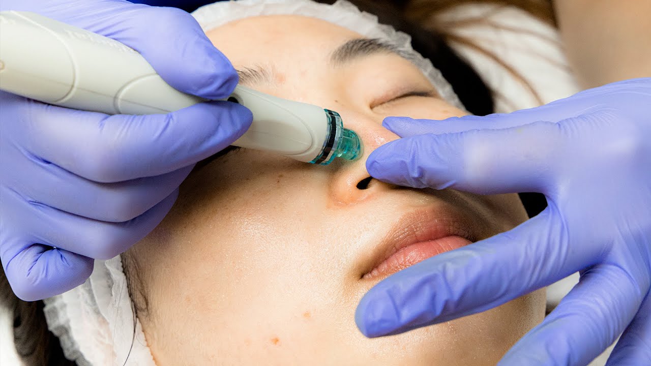 What is the Hydrafacial Treatment?
