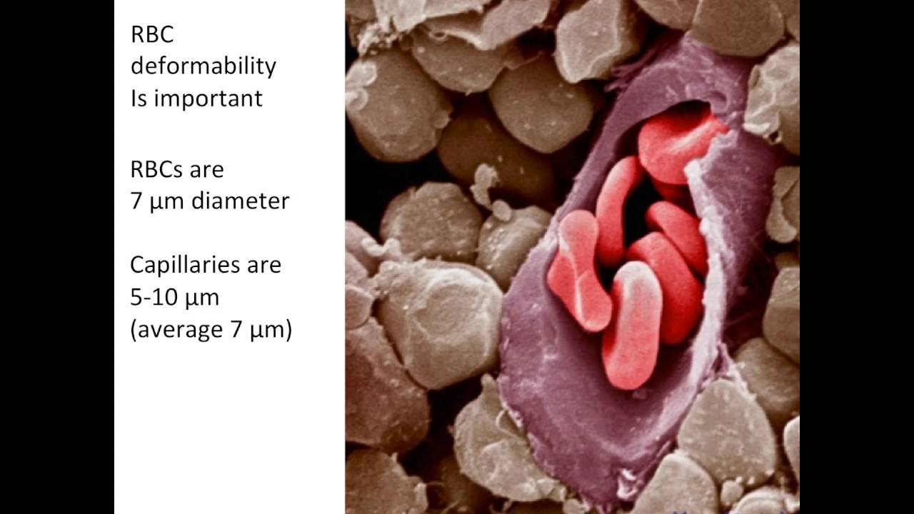 Evidence-Based Transfusion Practice and Patient Blood Management Programs - Steven Frank, MD