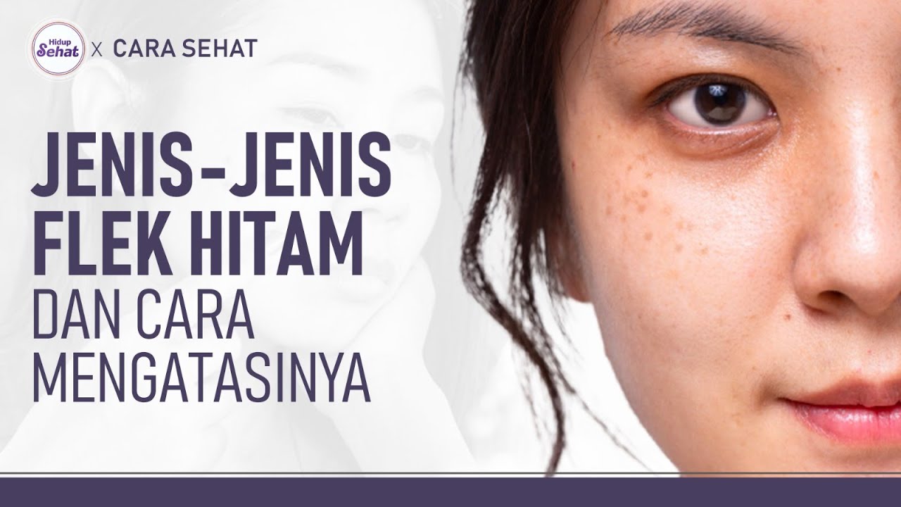 4 Jenis Flek di Wajah dan Cara Menghilangkannya | Hidup Sehat tvOne
