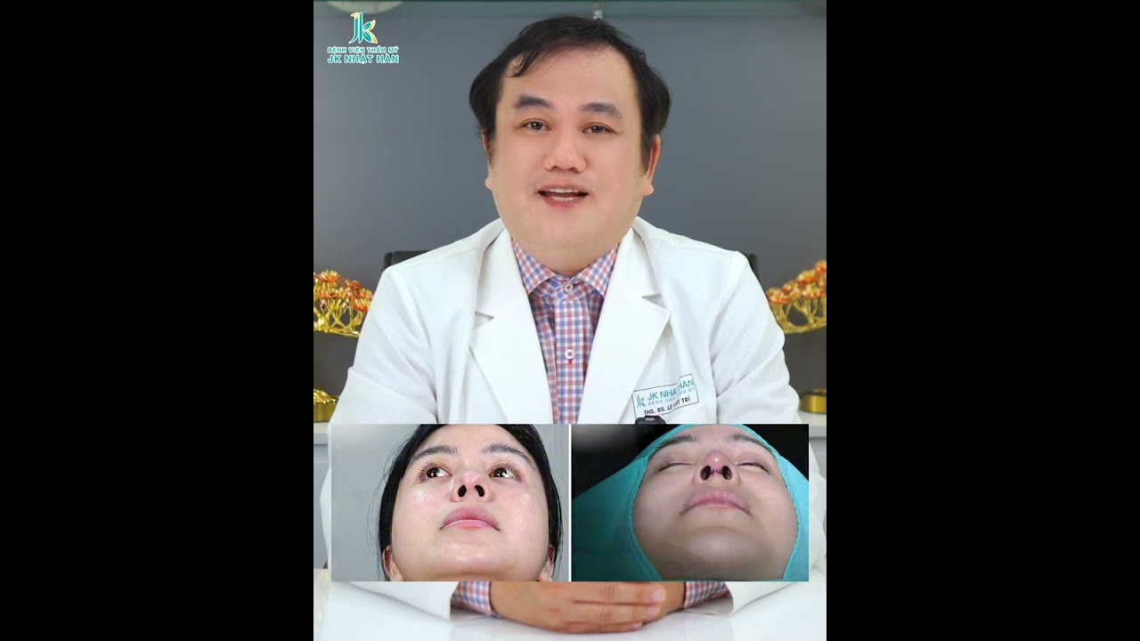 Vì Sao Nâng Mũi Phải Sửa Lại Nhiều Lần?