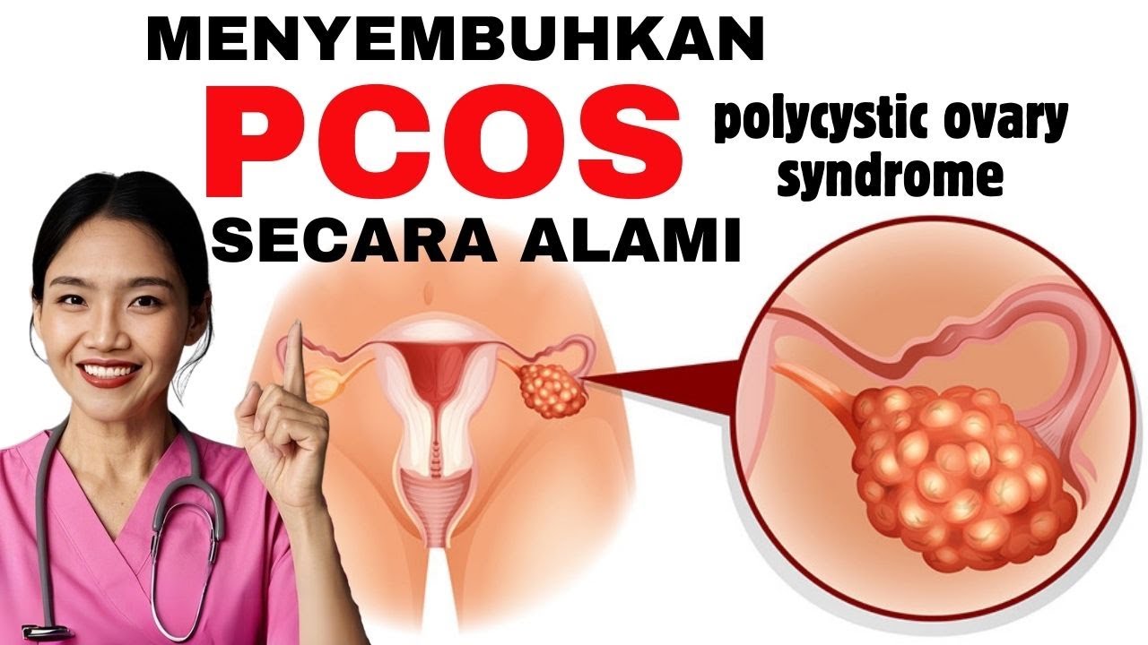Симптомы и причины СПКЯ у женщин – как лечить естественным путем | dr.Emasuperr