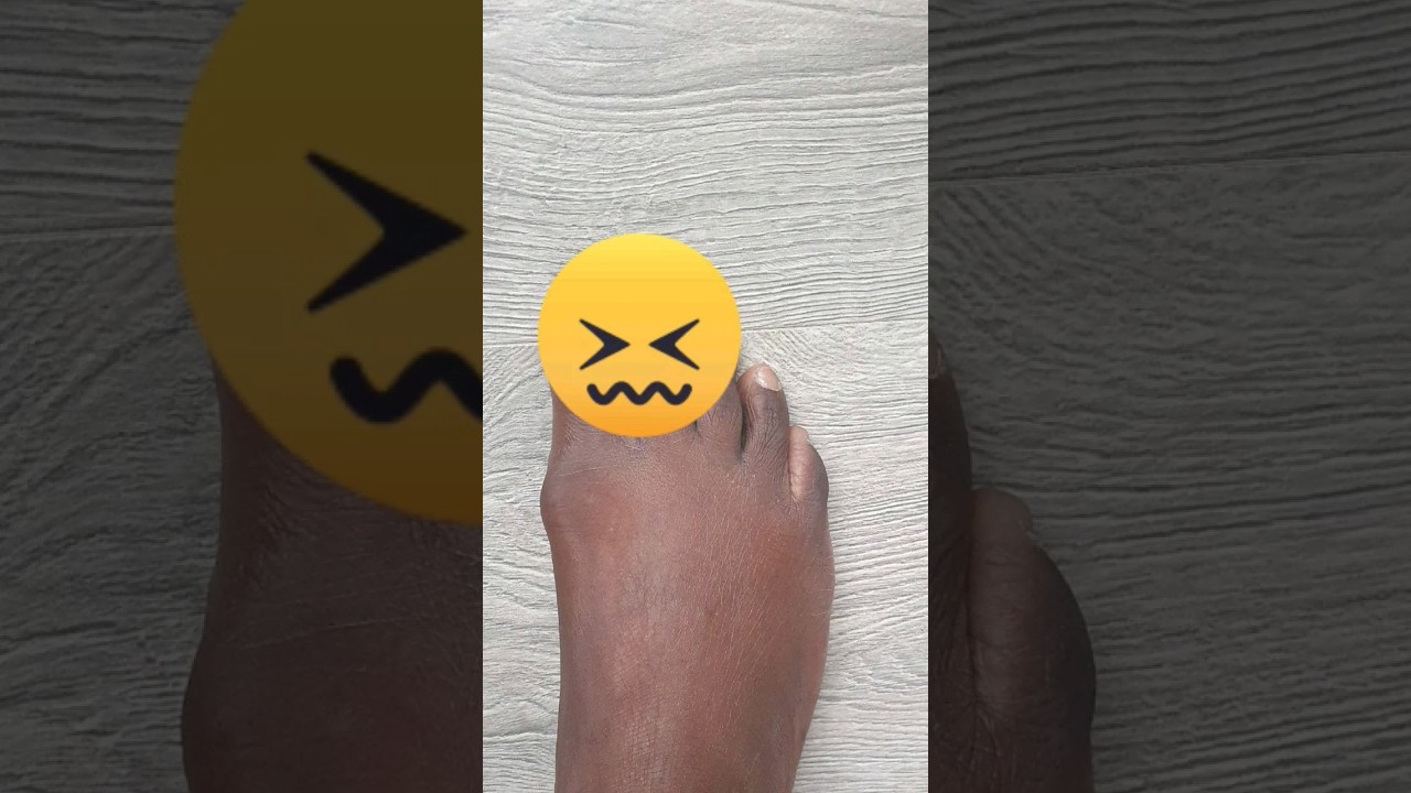 🤯 You won't believe this PROSTHETIC is 3000 years old!