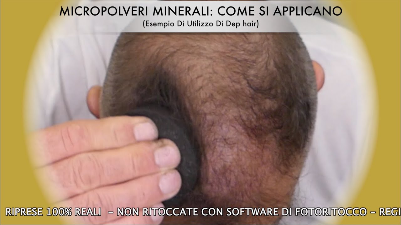 Tricosmetica - I Prodotti Nascondi Diradamento
