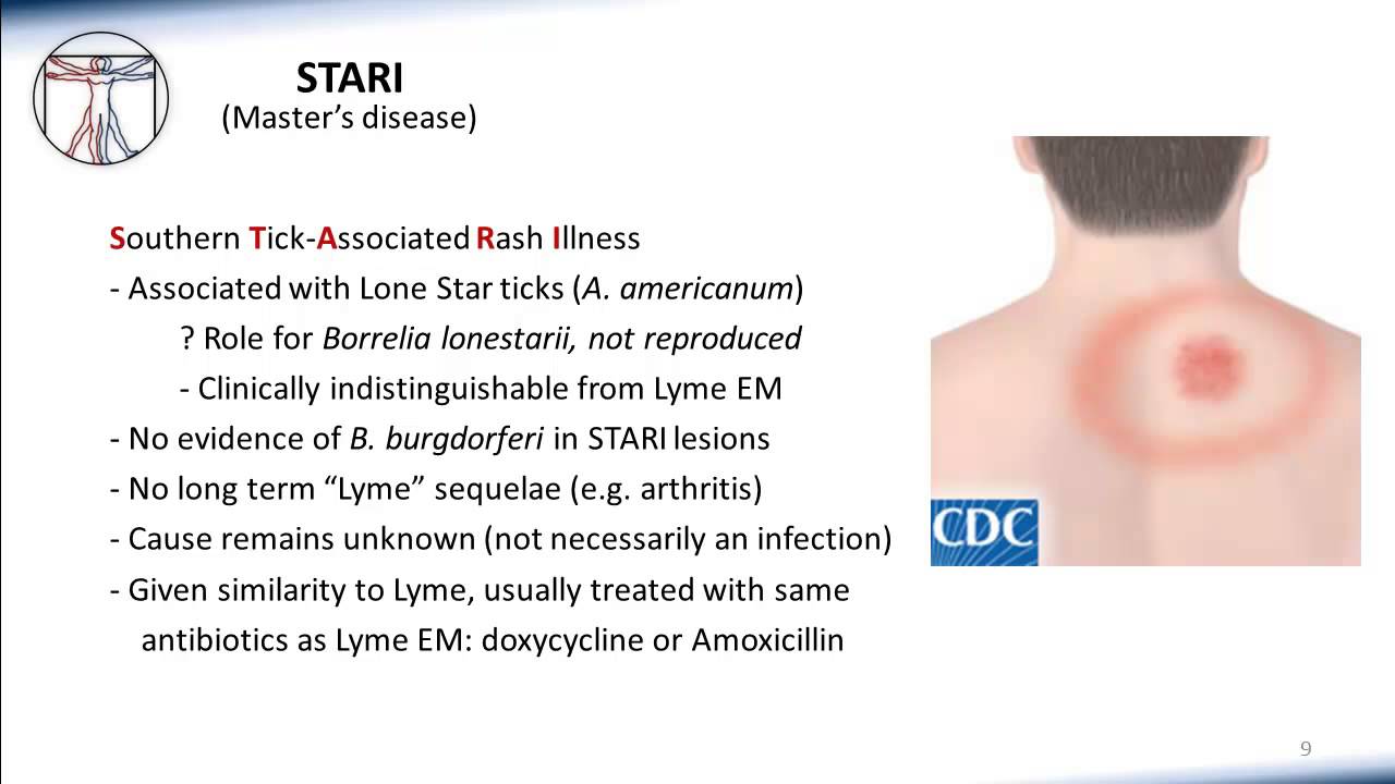 3. Rare Tickborne Disease of US