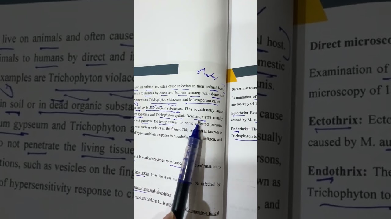 شرح محاضرة الفطريات النظري الخامسة مرحلة ثالثة مختبرات طبية وزاري ٢٠٢٦ /الاستاذ مسلم عقيل 
