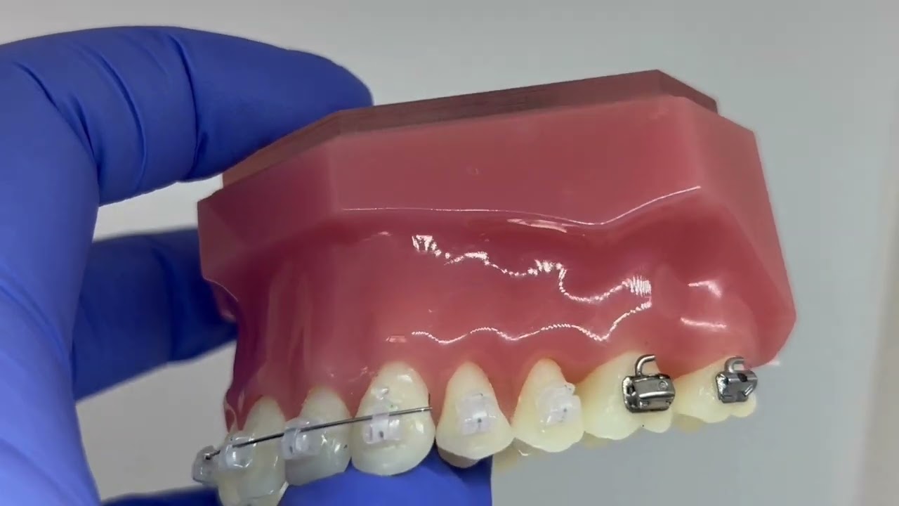 What to do if your wire breaks