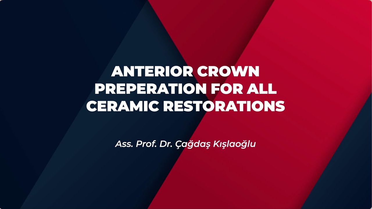 Anterior Tooth Preparation for Crowns | Complete Guide for Dental Students and Dentists