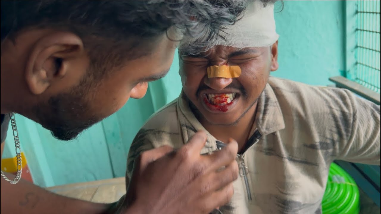 ಏನ್ ಆಯ್ತು ನಮ್ ಅಣ್ಣಂಗೆ..?😱