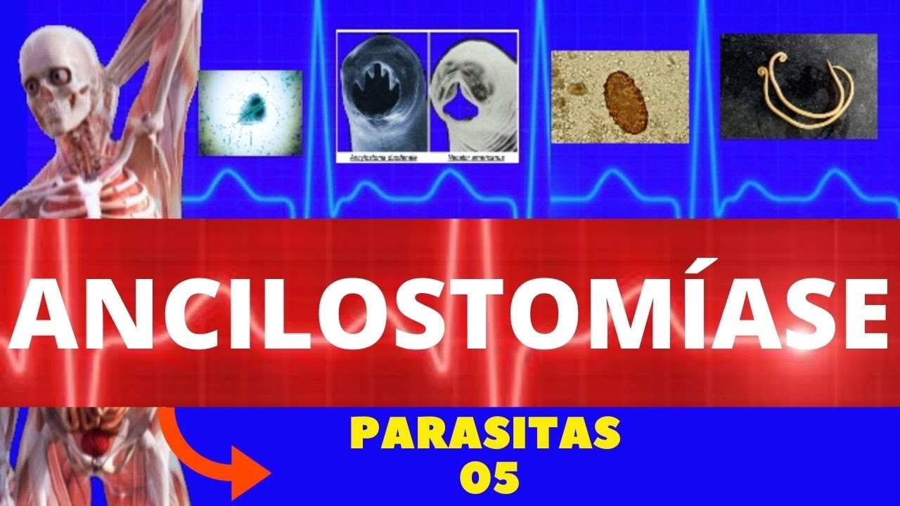 ANCILOSTOM&Iacute;ASE (AMAREL&Atilde;O) - ANCYLOSTOMA DUODENALE | NECATOR  AMERICANUS - PARASITOLOGIA