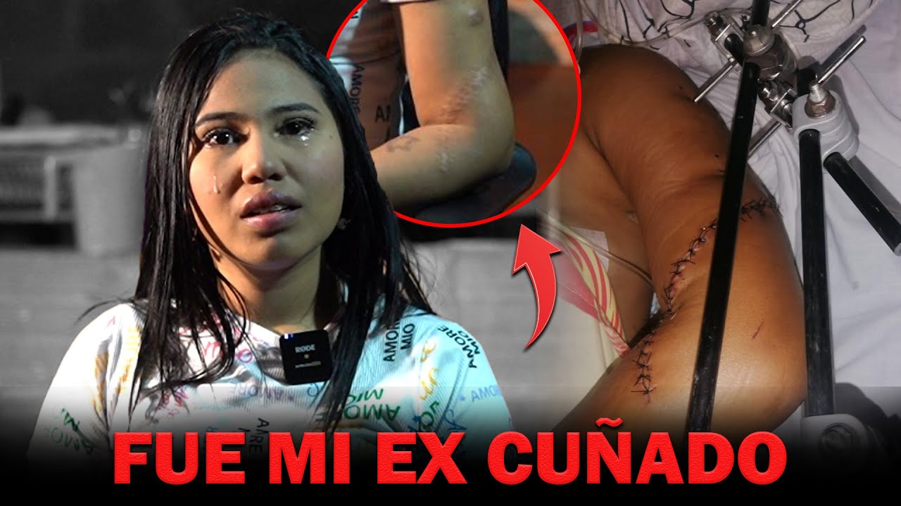Su ex CUÑADO casi le apaga su Luz, !SOBREVIVIÓ a varios MACHETASO¡ por un milagro de DIOS