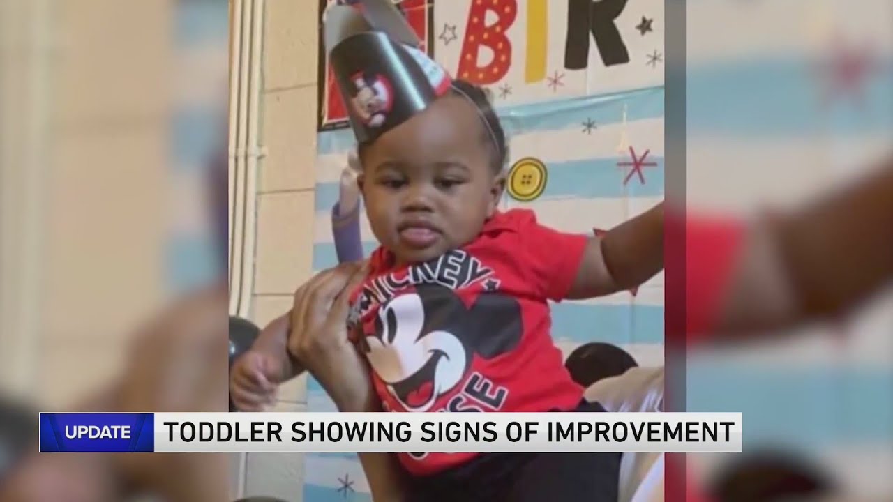 Doctors: Toddler shot in road rage incident showing signs of improvement