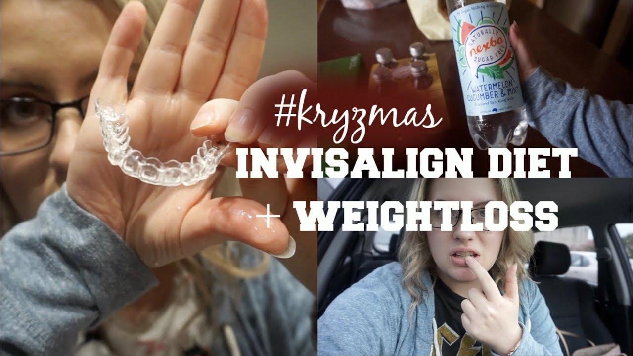 My Invisalign 
