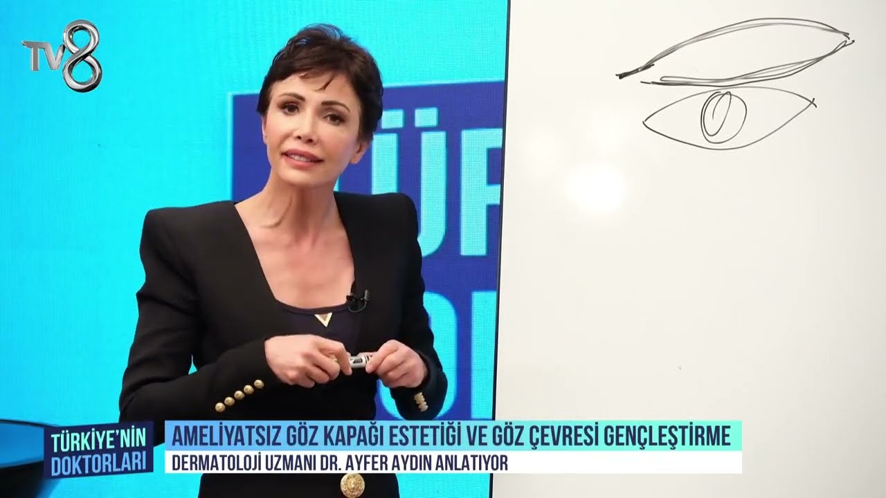 Dr.Ayfer Aydın - Ameliyatsız Göz Kapağı Estetiği