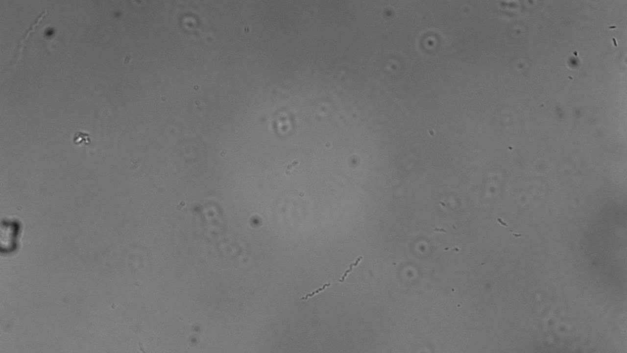 bed bugs feces infected with Borrelia recurrentis 10 DPI