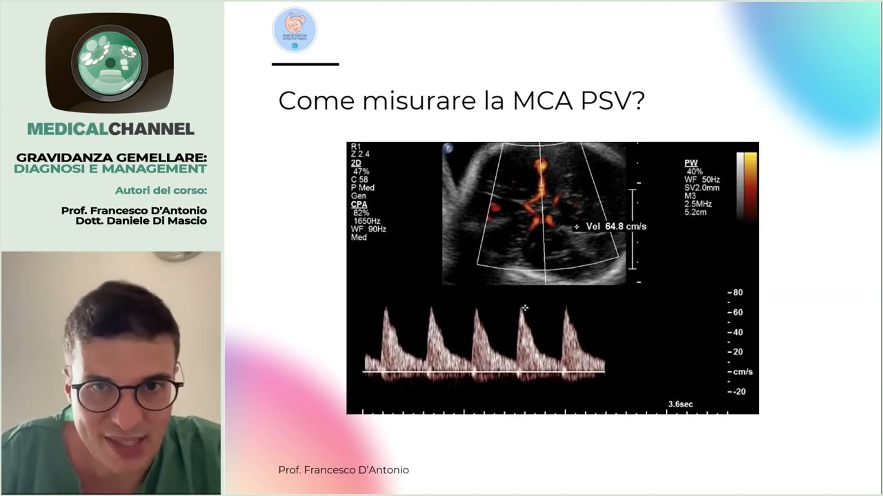 Complicanze delle gravidanze gemellari monocoriali. Sequenza anemia policitemia, TAPS e TRAP