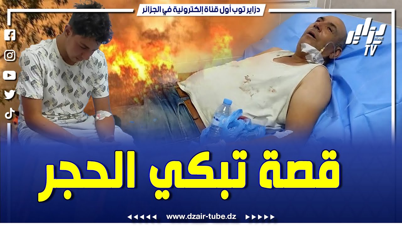 شاااااهد.. مكاش كيفاش ماتبكيش.. شاب نجى بأعجوبة من حريق بجاية يروي الأحداث الدرامية لقصة  نجاته..