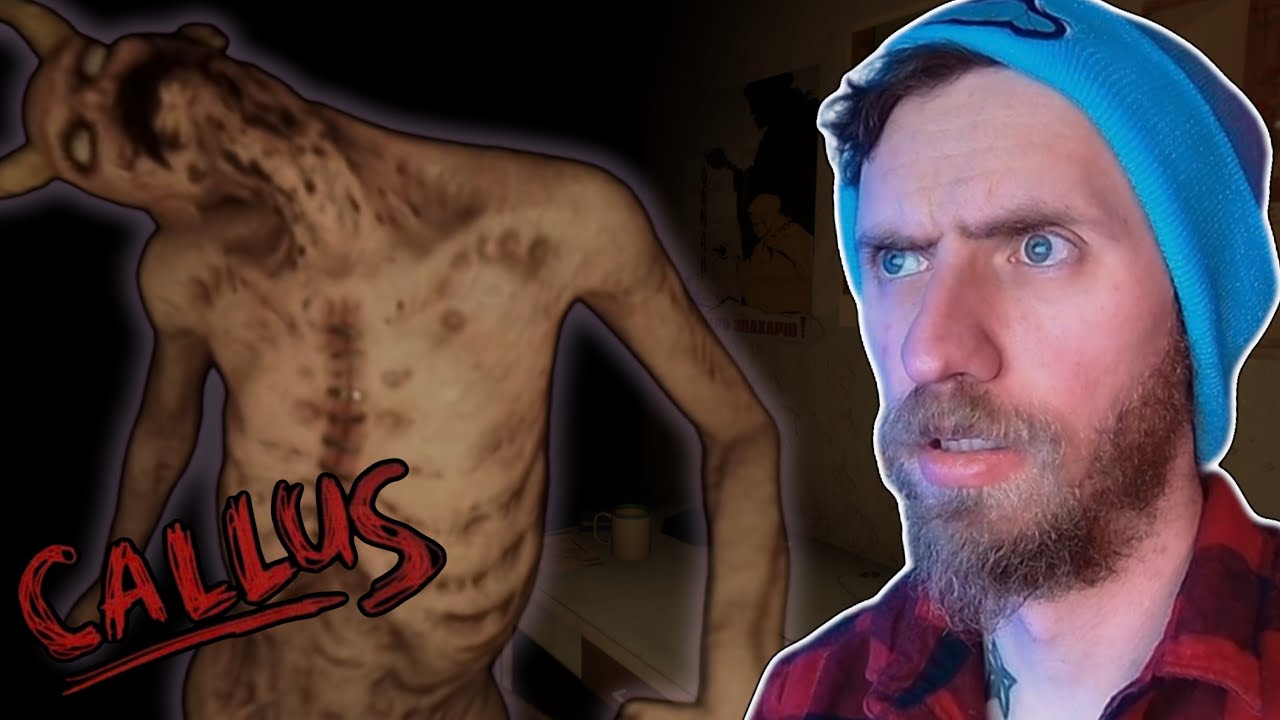 MOMMA SAID I&rsquo;D BE SAFE HERE | CALLUS [Full Game] (Let&rsquo;s Play)